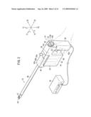 Intracoelomic suturing and ligating method diagram and image