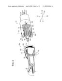 Intracoelomic suturing and ligating method diagram and image