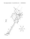 Intracoelomic suturing and ligating method diagram and image