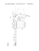 Intracoelomic suturing and ligating method diagram and image