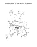 Intracoelomic suturing and ligating method diagram and image