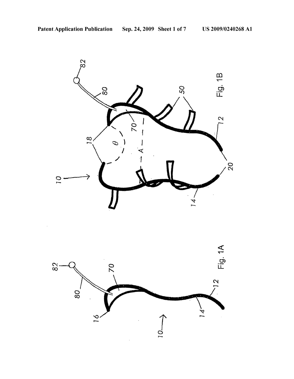 MAGNETIC DEVICES FOR ORGAN REMODELING - diagram, schematic, and image 02