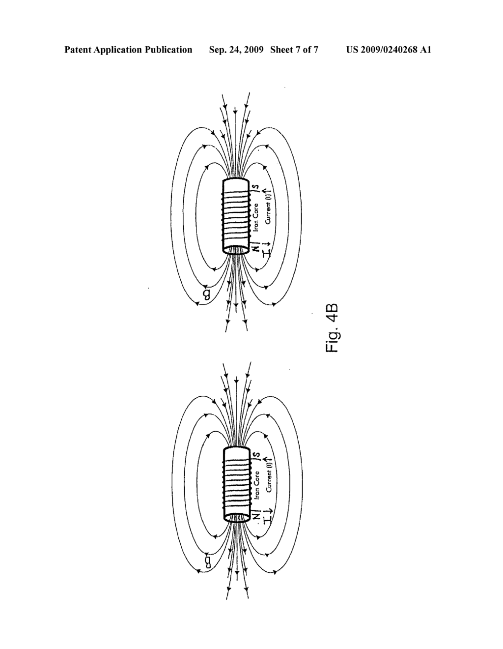 MAGNETIC DEVICES FOR ORGAN REMODELING - diagram, schematic, and image 08