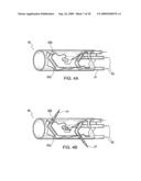 DEVICE AND METHOD FOR OPENING BLOOD VESSELS BY PRE-ANGIOPLASTY SERRATION AND DILATATION OF ATHEROSCLEROTIC PLAQUE diagram and image