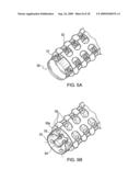 DEVICE AND METHOD FOR OPENING BLOOD VESSELS BY PRE-ANGIOPLASTY SERRATION AND DILATATION OF ATHEROSCLEROTIC PLAQUE diagram and image