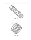 DEVICE AND METHOD FOR OPENING BLOOD VESSELS BY PRE-ANGIOPLASTY SERRATION AND DILATATION OF ATHEROSCLEROTIC PLAQUE diagram and image