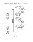 Interspinous implant, tools and methods of implanting diagram and image