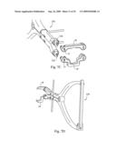 Interspinous implant, tools and methods of implanting diagram and image