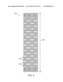 Intraluminal Flexible Stent Device diagram and image