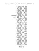 Intraluminal Flexible Stent Device diagram and image