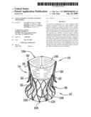 VALVE SUTURING AND IMPLANTATION PROCEDURES diagram and image