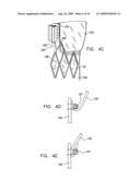 VALVE SUTURING AND IMPLANTATION PROCEDURES diagram and image