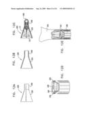 VALVE SUTURING AND IMPLANTATION PROCEDURES diagram and image