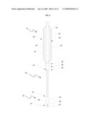 Implant Delivery and Deployment System and Method diagram and image