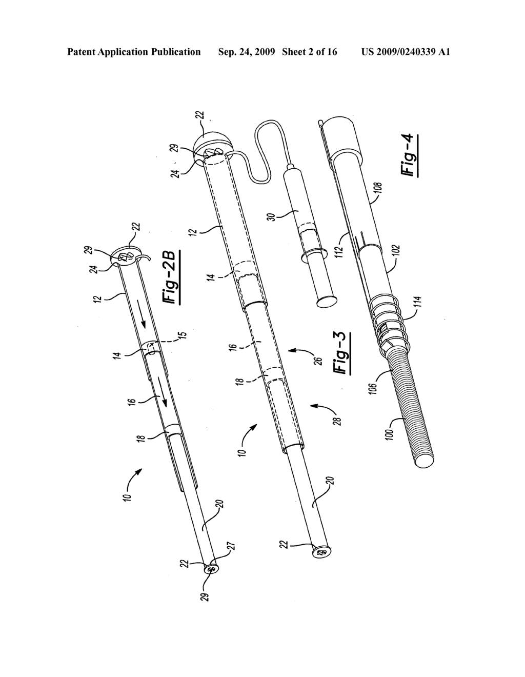 MECHANICAL EXTENSION IMPLANTS FOR SHORT BOWEL SYNDROME - diagram, schematic, and image 03