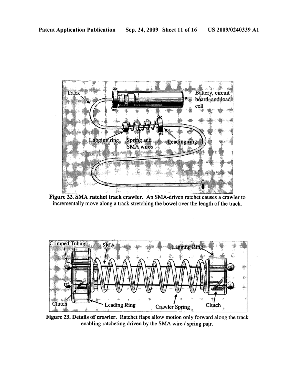 MECHANICAL EXTENSION IMPLANTS FOR SHORT BOWEL SYNDROME - diagram, schematic, and image 12