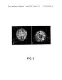 METHODS FOR CLONING FERRETS AND TRANSGENIC FERRET MODELS FOR DISEASES diagram and image