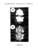 TANDEM REAPEAT DNA CONSTRUCTS PRODUCING PROTEINS THAT ATTACK PLANT PATHOGENIC VIRUSES, FUNGI, AND BACTERIA BY DISRUPTING TRANSCRIPTION FACTORS ESSENTIAL FOR REPLICATION THEREOF IN PLANTS diagram and image