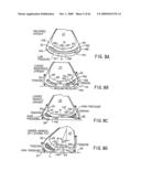 REMOVABLE ROUNDED MIDSOLE STRUCTURES AND CHAMBERS WITH COMPUTER PROCESSOR-CONTROLLED VARIABLE PRESSURE diagram and image