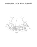 REMOVABLE ROUNDED MIDSOLE STRUCTURES AND CHAMBERS WITH COMPUTER PROCESSOR-CONTROLLED VARIABLE PRESSURE diagram and image