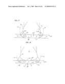 REMOVABLE ROUNDED MIDSOLE STRUCTURES AND CHAMBERS WITH COMPUTER PROCESSOR-CONTROLLED VARIABLE PRESSURE diagram and image