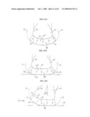 REMOVABLE ROUNDED MIDSOLE STRUCTURES AND CHAMBERS WITH COMPUTER PROCESSOR-CONTROLLED VARIABLE PRESSURE diagram and image