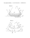 REMOVABLE ROUNDED MIDSOLE STRUCTURES AND CHAMBERS WITH COMPUTER PROCESSOR-CONTROLLED VARIABLE PRESSURE diagram and image