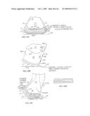 REMOVABLE ROUNDED MIDSOLE STRUCTURES AND CHAMBERS WITH COMPUTER PROCESSOR-CONTROLLED VARIABLE PRESSURE diagram and image