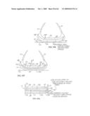 REMOVABLE ROUNDED MIDSOLE STRUCTURES AND CHAMBERS WITH COMPUTER PROCESSOR-CONTROLLED VARIABLE PRESSURE diagram and image