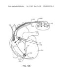 SHIELDED THREE-TERMINAL FLAT-THROUGH EMI/ENERGY DISSIPATING FILTER diagram and image