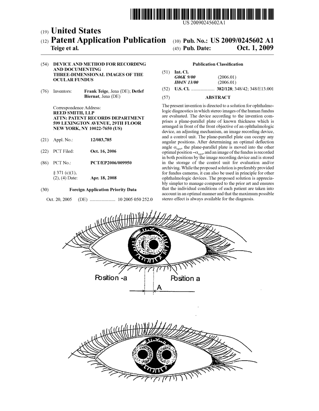 Device and Method for Recording and Documenting Three-Dimensional Images of the Ocular Fundus - diagram, schematic, and image 01