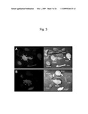 METHODS AND COMPOSITIONS RELATED TO INTERNALIZING RGD PEPTIDES diagram and image