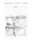 Lipid metabolism improving agent containing hydrogen molecules diagram and image