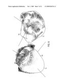 RECONSTRUCTION OF NON-VISIBLE PART OF TOOTH diagram and image