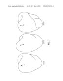 RECONSTRUCTION OF NON-VISIBLE PART OF TOOTH diagram and image