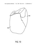 RECONSTRUCTION OF NON-VISIBLE PART OF TOOTH diagram and image