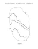 RECONSTRUCTION OF NON-VISIBLE PART OF TOOTH diagram and image