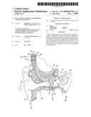 DUAL PERCUTANEOUS ANCHORS BONE CONDUCTION DEVICE diagram and image