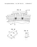 DUAL PERCUTANEOUS ANCHORS BONE CONDUCTION DEVICE diagram and image