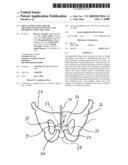 IMPLANTABLE SLING FOR THE TREATMENT OF INCONTINENCE AND METHOD OF USING THE SAME diagram and image