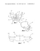 IMPLANTABLE SLING FOR THE TREATMENT OF INCONTINENCE AND METHOD OF USING THE SAME diagram and image