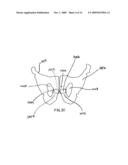 IMPLANTABLE SLING FOR THE TREATMENT OF INCONTINENCE AND METHOD OF USING THE SAME diagram and image