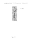 IMPLANTABLE SLING FOR THE TREATMENT OF INCONTINENCE AND METHOD OF USING THE SAME diagram and image