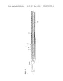 ENDOSCOPE TREATMENT INSTRUMENT diagram and image