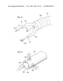 ENDOSCOPE TREATMENT INSTRUMENT diagram and image