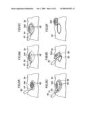 Instrument for Endoscopic Treatment diagram and image