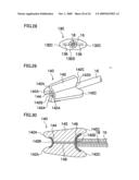 Instrument for Endoscopic Treatment diagram and image