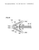 Instrument for Endoscopic Treatment diagram and image