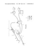 ENDOSCOPE, DISTAL END CAP-EQUIPPED ENDOSCOPE AND ENDOSCOPE CLEANING SHEATH diagram and image