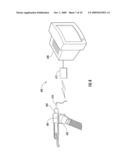 ADAPTER FOR REMOVABLY COUPLING A CAMERA TO A LARYNGOSCOPE AND LARYNGOSCOPE AND SYSTEM USING SAME diagram and image